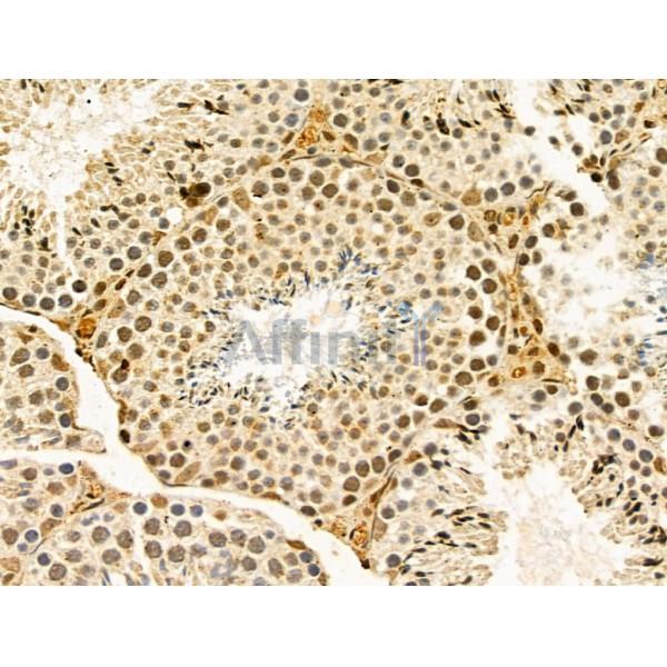 HNRNPR Antibody - DF13065 at 1/100 staining Mouse testis tissue by IHC-P.