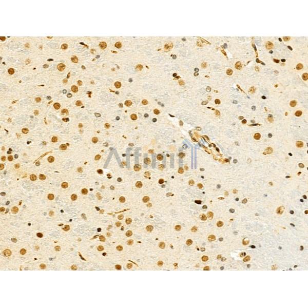 HNRNPR Antibody - DF13065 at 1/100 staining Mouse brain tissue by IHC-P.