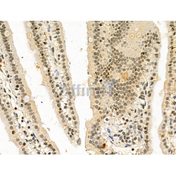 HOXB7 Antibody - DF13068 at 1/100 staining Mouse colon tissue by IHC-P.