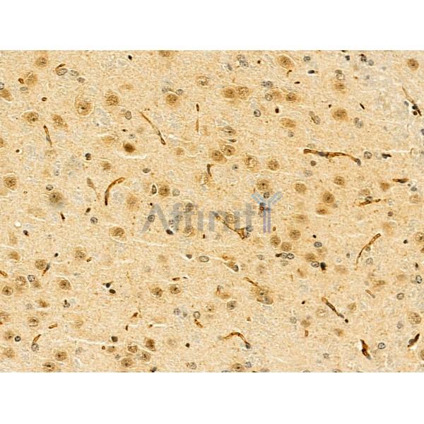 HOXB7 Antibody - DF13068 at 1/100 staining Mouse brain tissue by IHC-P.