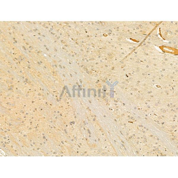 HPS3 Antibody - DF13071 at 1/100 staining Rat brain tissue by IHC-P.