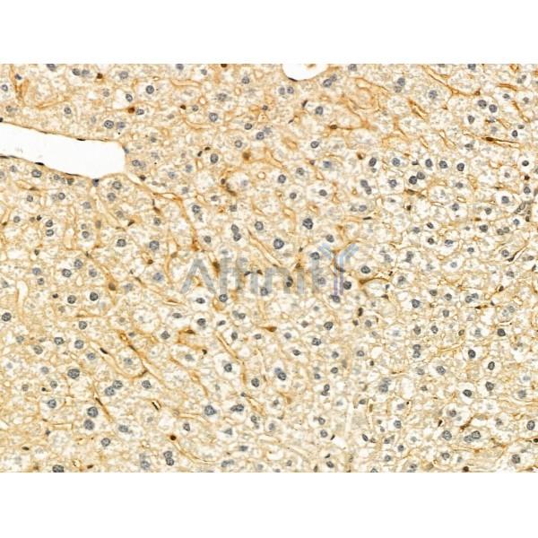 HPS3 Antibody - DF13071 at 1/100 staining Mouse liver tissue by IHC-P.