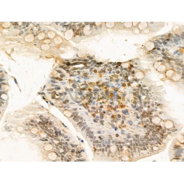 HRSP12 Antibody - DF13072 at 1/100 staining Rat colon tissue by IHC-P.