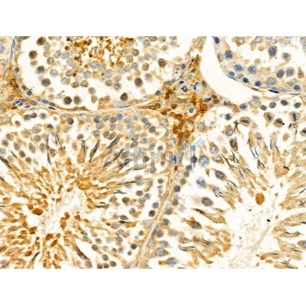 HSDL2 Antibody - DF13074 at 1/100 staining Rat testis tissue by IHC-P.