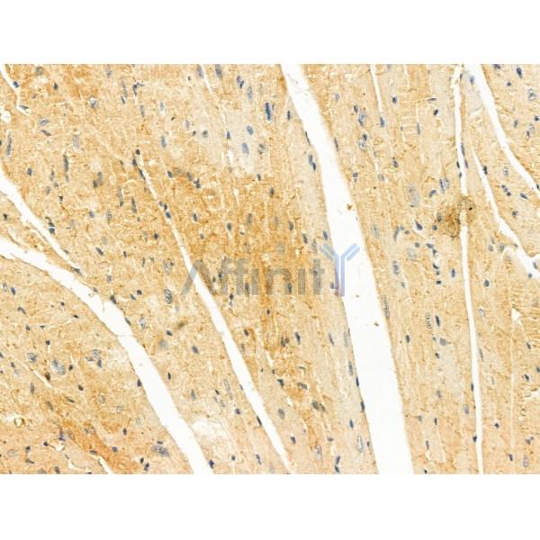 IIP45 Antibody - DF13086 at 1/100 staining Mouse heart tissue by IHC-P.