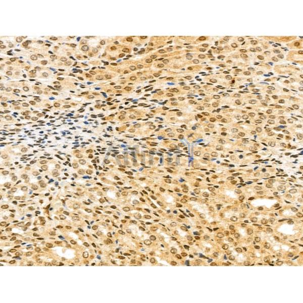 KCNAB2 Antibody - DF13103 at 1/100 staining Rat kidney tissue by IHC-P.