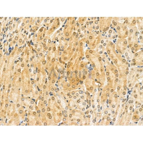 KCNAB2 Antibody - DF13103 at 1/100 staining Mouse kidney tissue by IHC-P.