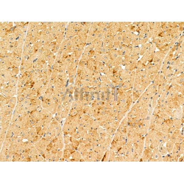 KIAA0182 Antibody - DF13107 at 1/100 staining Rat heart tissue by IHC-P.