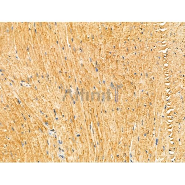 KIF19 Antibody - DF13109 at 1/100 staining Mouse heart tissue by IHC-P.