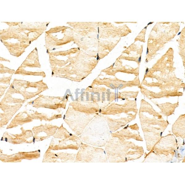 KLHL18 Antibody - DF13115 at 1/100 staining Mouse muscle tissue by IHC-P.