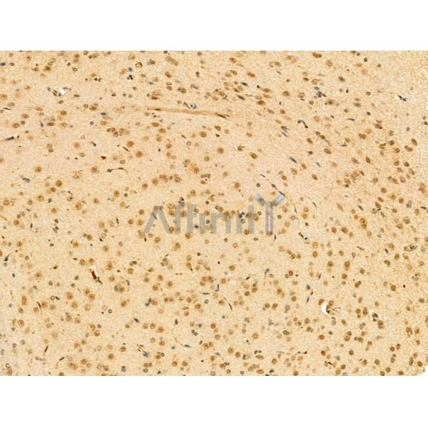 KLHL18 Antibody - DF13115 at 1/100 staining Mouse brain tissue by IHC-P.
