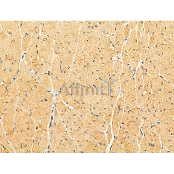 LACTB Antibody - DF13120 at 1/100 staining Rat heart tissue by IHC-P.