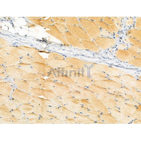 LACTB Antibody - DF13120 at 1/100 staining Rat skin tissue by IHC-P.