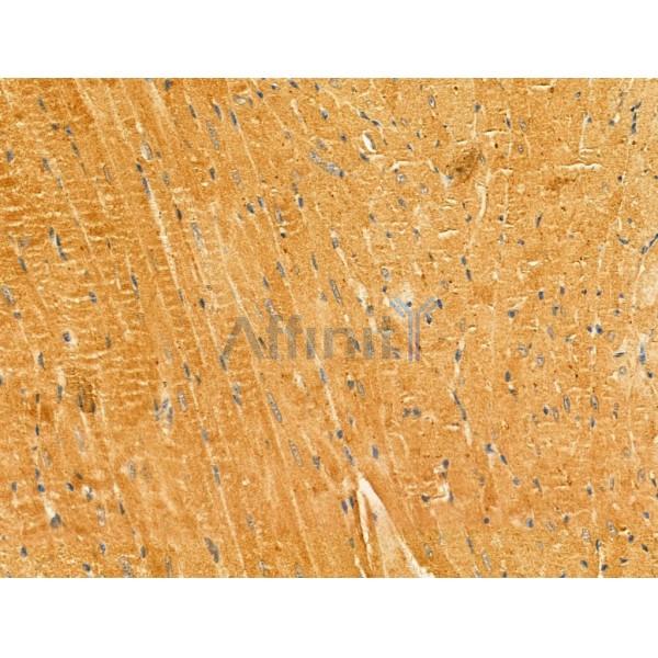LACTB Antibody - DF13120 at 1/100 staining Mouse heart tissue by IHC-P.