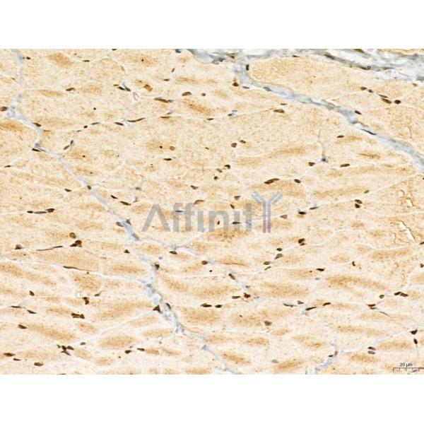LAS1L Antibody - DF13123 at 1/100 staining Rat skin tissue by IHC-P.