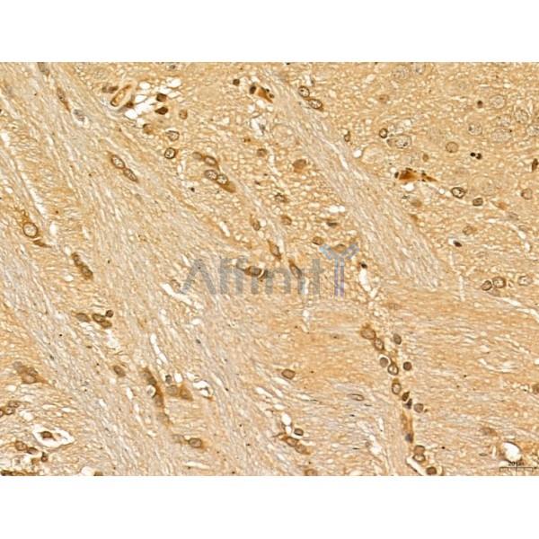 LAS1L Antibody - DF13123 at 1/100 staining Rat brain tissue by IHC-P.