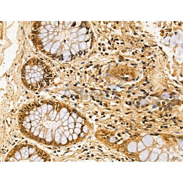 LAS1L Antibody - DF13123 at 1/100 staining Human normal tissues adjacent to colorectal cancer by IHC-P.