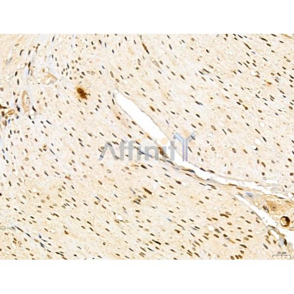 LAS1L Antibody - DF13123 at 1/100 staining Mouse stomach tissue by IHC-P.