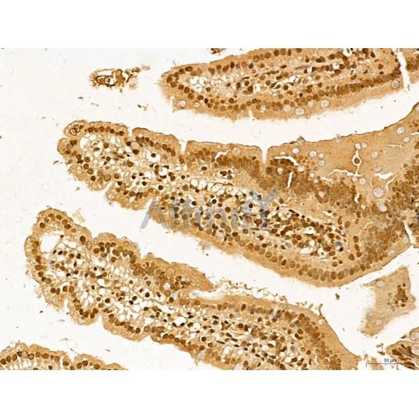 LAS1L Antibody - DF13123 at 1/100 staining Mouse colon tissue by IHC-P.