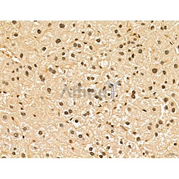 LAS1L Antibody - DF13123 at 1/100 staining Mouse liver tissue by IHC-P.