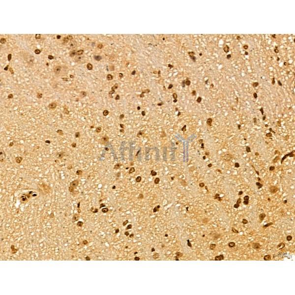 LAS1L Antibody - DF13123 at 1/100 staining Mouse brain tissue by IHC-P.