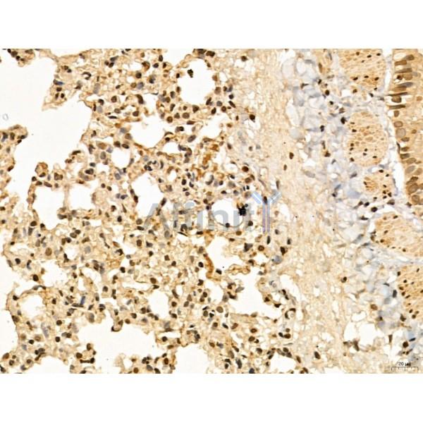 LAS1L Antibody - DF13123 at 1/100 staining Rat lung tissue by IHC-P.