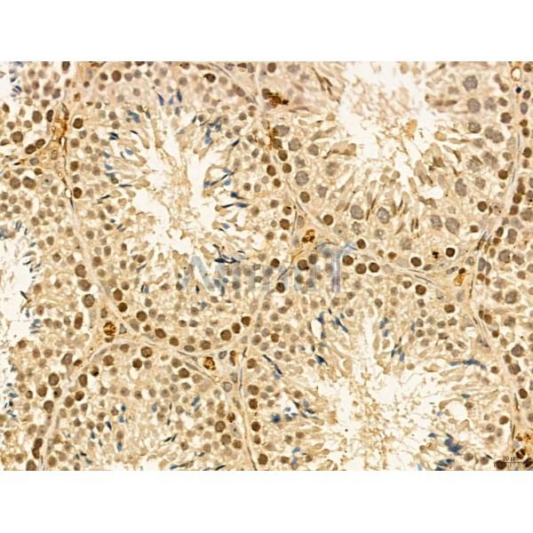 LAS1L Antibody - DF13123 at 1/100 staining Mouse testis tissue by IHC-P.