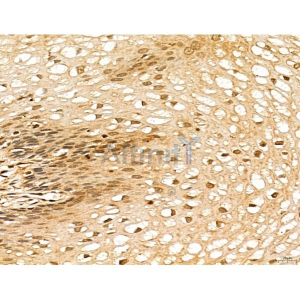 LAS1L Antibody - DF13123 at 1/100 staining Human normal tissues adjacent to esophageal cancer by IHC-P.