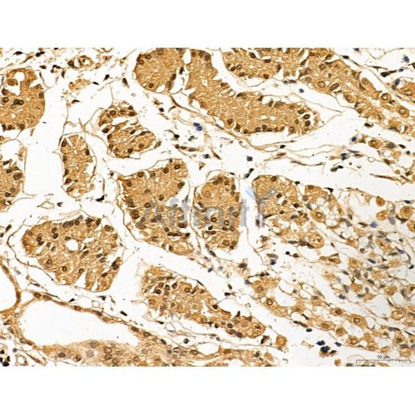 LAS1L Antibody - DF13123 at 1/100 staining Human normal tissues adjacent to gastric cancer by IHC-P.