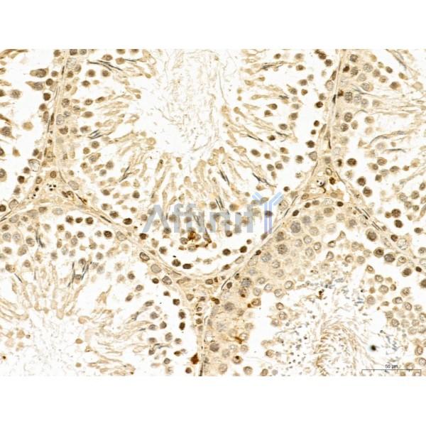 LAS1L Antibody - DF13123 at 1/100 staining Rat testis tissue by IHC-P.