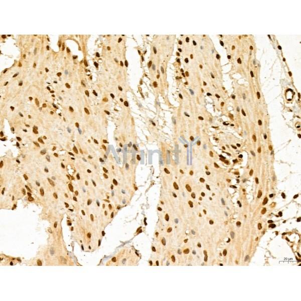 LAS1L Antibody - DF13123 at 1/100 staining Rat stomach tissue by IHC-P.