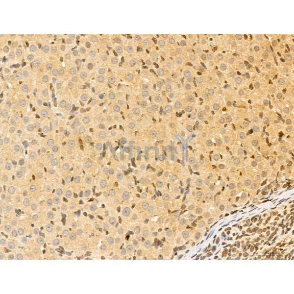 LAS1L Antibody - DF13123 at 1/100 staining Rat ovary tissue by IHC-P.
