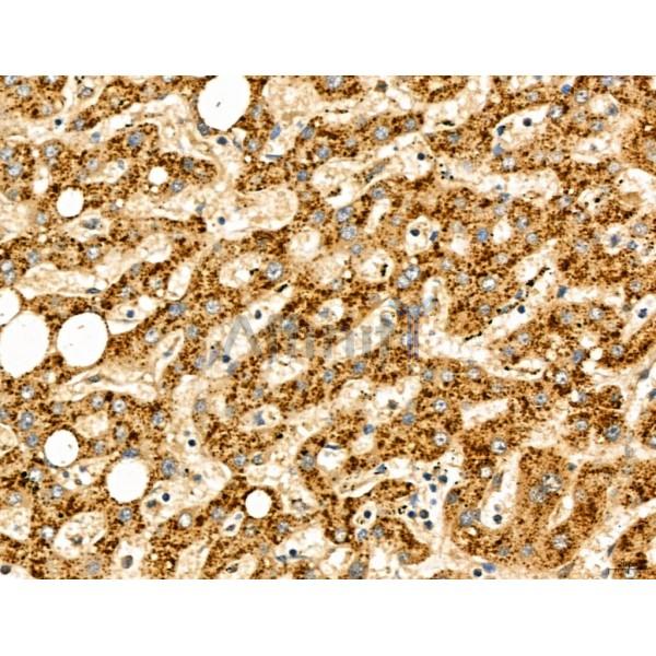 LCA5 Antibody - DF13126 at 1/100 staining Human normal tissues adjacent to liver cancer by IHC-P.