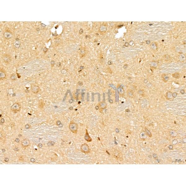 LETM2 Antibody - DF13128 at 1/100 staining Rat brain tissue by IHC-P.