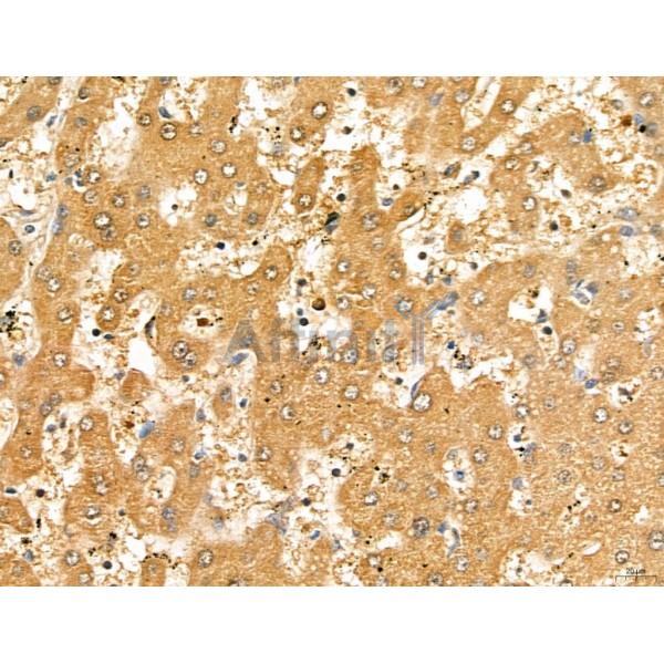 LETM2 Antibody - DF13128 at 1/100 staining Human normal tissues adjacent to liver cancer by IHC-P.