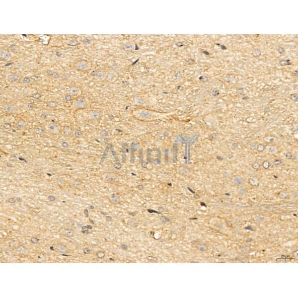 LIN7C Antibody - DF13130 at 1/100 staining Rat brain tissue by IHC-P.