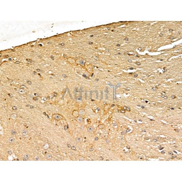 LIN7C Antibody - DF13130 at 1/100 staining Mouse brain tissue by IHC-P.