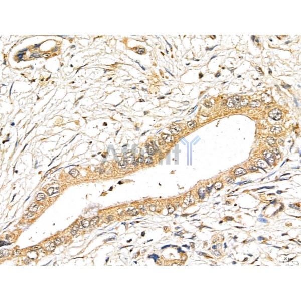 LIN7C Antibody - DF13130 at 1/100 staining Human normal tissues adjacent to pancreatic cancer by IHC-P.