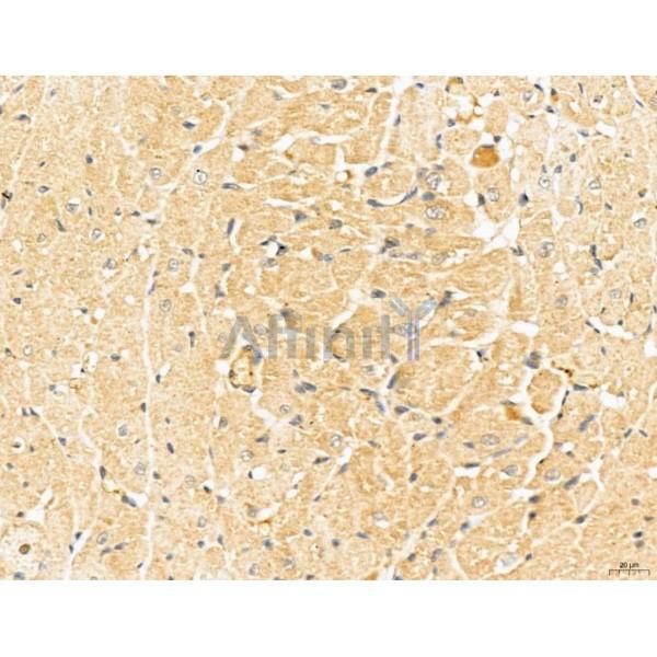 LOH12CR1 Antibody - DF13131 at 1/100 staining Rat heart tissue by IHC-P.