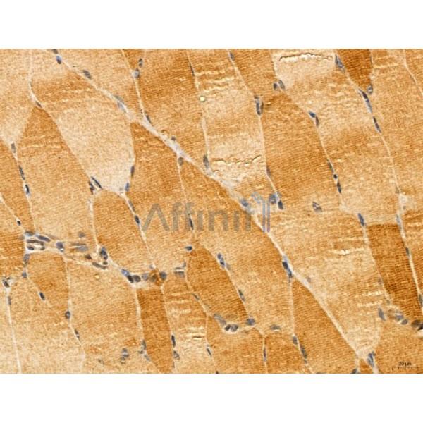 LOH12CR1 Antibody - DF13131 at 1/100 staining Rat muscle tissue by IHC-P.