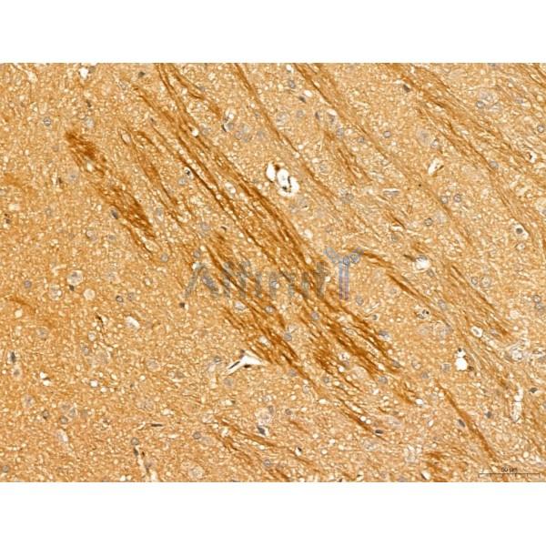 LOH12CR1 Antibody - DF13131 at 1/100 staining Rat brain tissue by IHC-P.