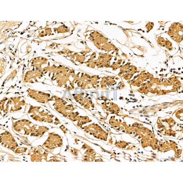 LOH12CR1 Antibody - DF13131 at 1/100 staining Human normal tissues adjacent to gastric cancer by IHC-P.