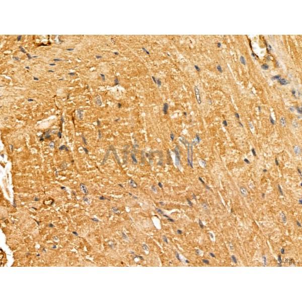 LOH12CR1 Antibody - DF13131 at 1/100 staining Mouse heart tissue by IHC-P.