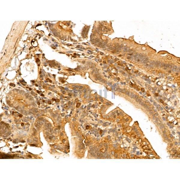 LOH12CR1 Antibody - DF13131 at 1/100 staining Mouse colon tissue by IHC-P.