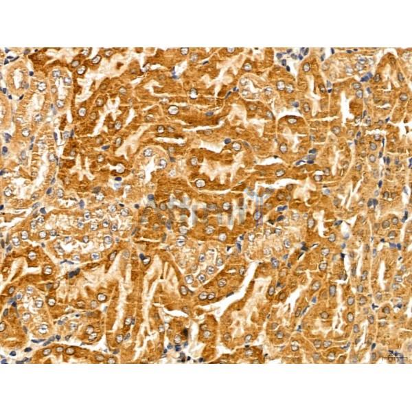 LOH12CR1 Antibody - DF13131 at 1/100 staining Mouse kidney tissue by IHC-P.