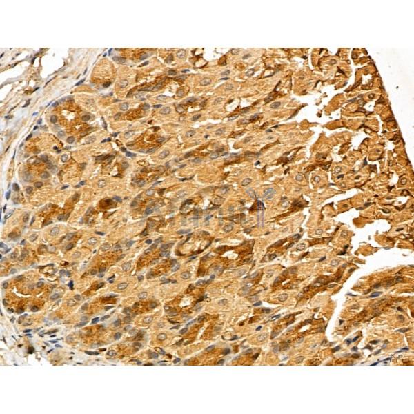 LOH12CR1 Antibody - DF13131 at 1/100 staining Mouse stomach tissue by IHC-P.