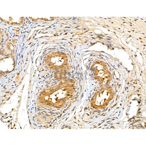 LOH12CR1 Antibody - DF13131 at 1/100 staining Rat ovary tissue by IHC-P.