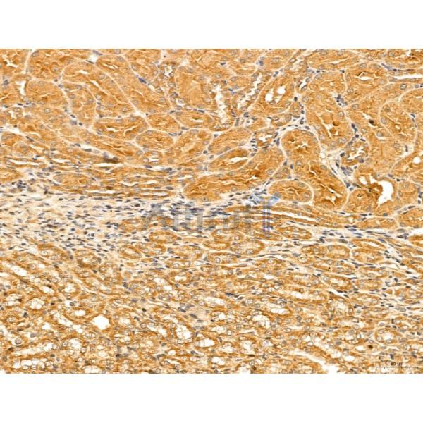LOH12CR1 Antibody - DF13131 at 1/100 staining Rat kidney tissue by IHC-P.