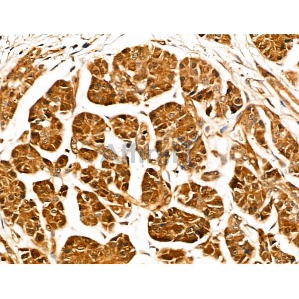 LOH12CR1 Antibody - DF13131 at 1/100 staining Human normal tissues adjacent to pancreatic cancer by IHC-P.
