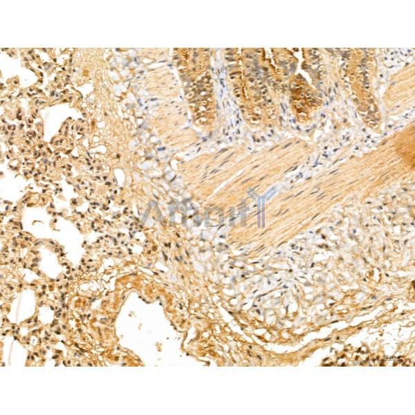 LOH12CR1 Antibody - DF13131 at 1/100 staining Rat lung tissue by IHC-P.